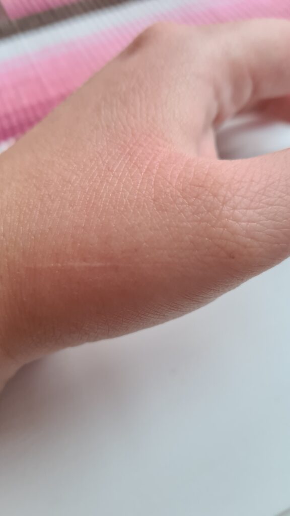 Mai™ SKIN gav hjälp mot Idas torra händer